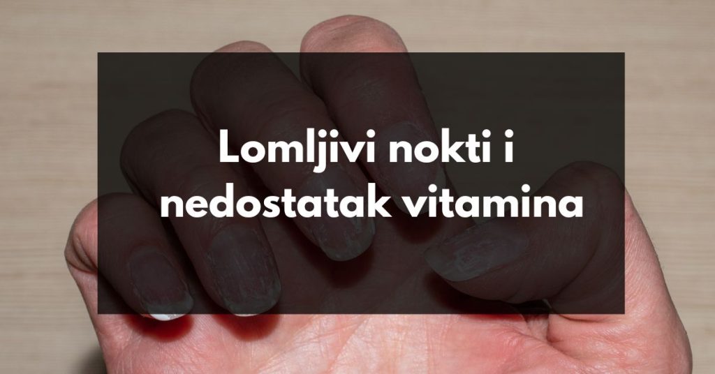 Lomljivi nokti i nedostatak vitamina
