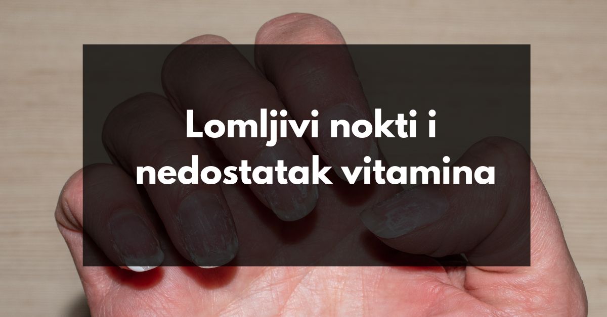 Lomljivi nokti i nedostatak vitamina